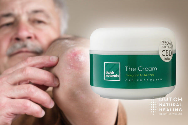 CBD oil for psoriasis: How can hemp oil may help the autoimmune disease