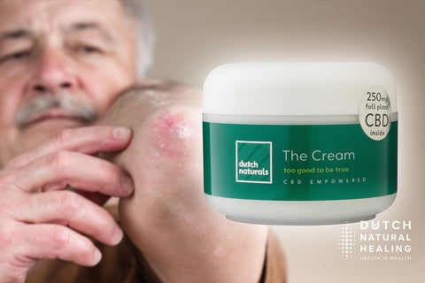 CBD oil for psoriasis: How can hemp oil may help the autoimmune disease - Dutch Natural Healing